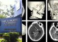 El Instituto Nacional de Neurología deja de realizar procedimientos por falta de recursos