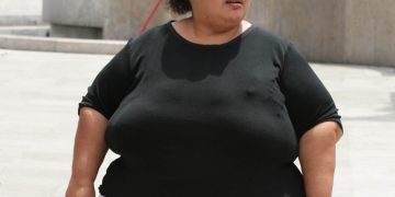 Tres de cada diez personas con obesidad sufren trastornos mentales