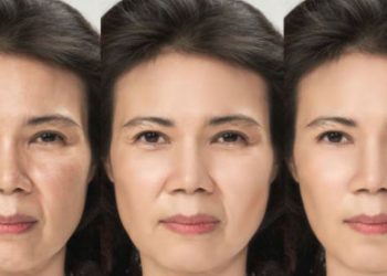 Para lucir 5 años más joven, realiza estos ejercicios de yoga facial