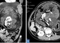 ¡Sorprendente! Joven vive con un ‘gemelo’ dentro de su cuerpo sin saberlo