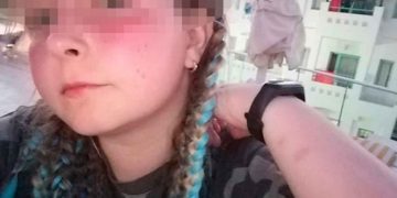 Muere menor tras ser succionada por tubería de alberca