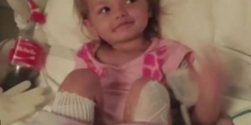 Por portarse mal mete a la  hija de su nuera en agua hirviendo; puede perder los pies
