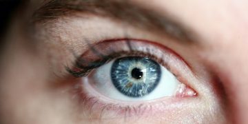 Un simple picazón podría ser un tumor cerebral, así le paso a una mujer que lo confundió con una alergia
