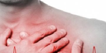 Aumentan infartos en millennials debido a tabaquismo y sedentarismo