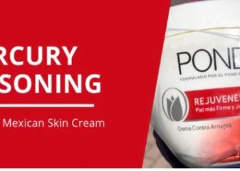 Por usar famosa crema facial alterada mujer cae en  estado semi-comatoso