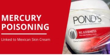 Por usar famosa crema facial alterada mujer cae en  estado semi-comatoso