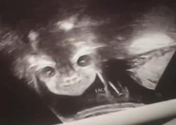 Diabólicas imágenes de la cara de un bebé durante un ultrasonido