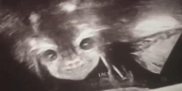 Diabólicas imágenes de la cara de un bebé durante un ultrasonido