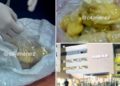Sujeto traía condones con ‘coca’ en el estómago y uno le reventó; esta agonizando