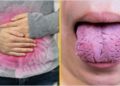 Según el aspecto de tu lengua podrías tener estas enfermedades