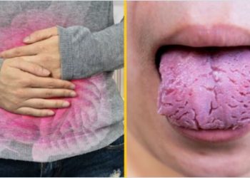Según el aspecto de tu lengua podrías tener estas enfermedades