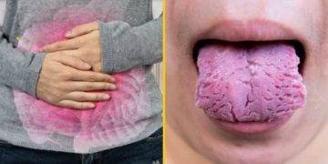 Según el aspecto de tu lengua podrías tener estas enfermedades