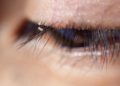 Advierten sobre peligro de piojos en pestañas
