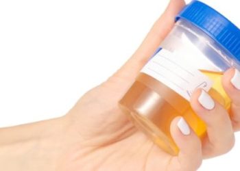 Prueba de orina podría suplir al papanicolaou en detección de cáncer