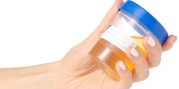Prueba de orina podría suplir al papanicolaou en detección de cáncer