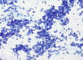 Trazan las líneas generales de un nuevo tratamiento para el cáncer