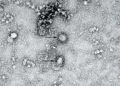 China publica la primera imagen del coronavirus