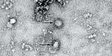 China publica la primera imagen del coronavirus