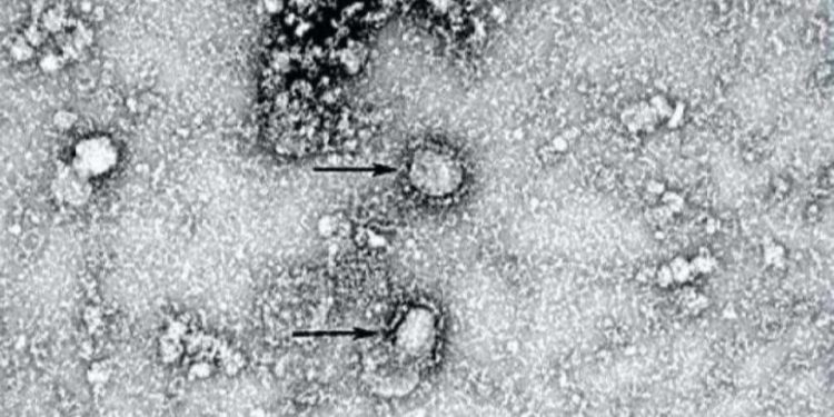 China publica la primera imagen del coronavirus