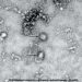 China publica la primera imagen del coronavirus