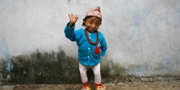 Murió el hombre más pequeño del mundo a los 27 años