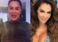 Ninel Conde se lastimó la rodilla; “Me estuve inyectando una cosa que te retiene líquidos y te hinchas”