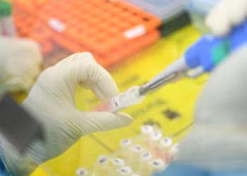 La OMS anuncia que la vacuna contra el coronavirus podría estar lista en 18 meses