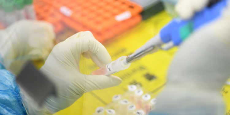 La OMS anuncia que la vacuna contra el coronavirus podría estar lista en 18 meses