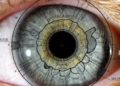 5 cosas que puedes saber de tu salud mirando tus ojos