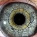 5 cosas que puedes saber de tu salud mirando tus ojos