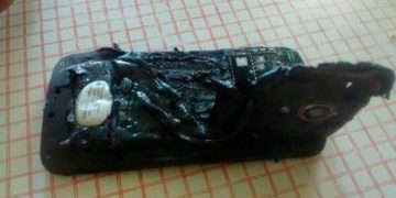 Se despertó “en llamas” tras dormir con su teléfono