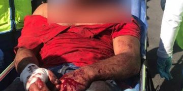 “Si no te mato hoy, será otro día”, hombre apuñala a exesposa en Iztapalapa