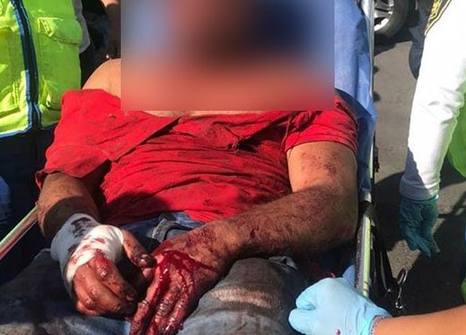 “Si no te mato hoy, será otro día”, hombre apuñala a exesposa en Iztapalapa