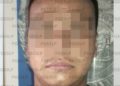 DETIENEN EN VILLA DE REYES A SUJETO POR LESIONES