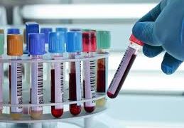 ¿Con qué grupo sanguíneo es más probable contraer el coronavirus?