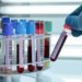 ¿Con qué grupo sanguíneo es más probable contraer el coronavirus?