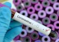 Estos son los laboratorios certificados que pueden hacer pruebas de Covid-19 en México