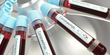 Software colombiano diagnostica casos sospechosos de Covid-19
