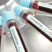 Software colombiano diagnostica casos sospechosos de Covid-19