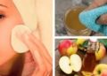 Vinagre de manzana y la salud de la piel