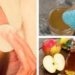 Vinagre de manzana y la salud de la piel