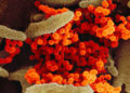 Cómo el cuerpo humano se defiende del nuevo coronavirus SARS-Cov-2