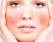 ¿Por qué siento calor en mi cara?