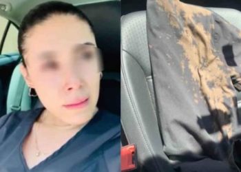 Me quemaba horrible; personas arrojan cloro a enfermera de Zapopan