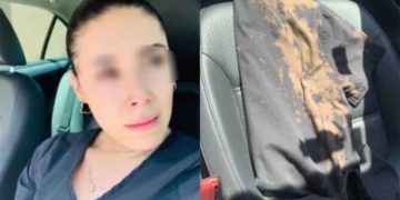 Me quemaba horrible; personas arrojan cloro a enfermera de Zapopan