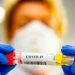 Un anticuerpo monoclonal humano bloquea la infección por sars-CoV-2