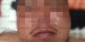 Detenido por atacar a policía de investigación en Cerritos