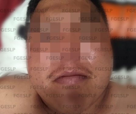 Detenido por atacar a policía de investigación en Cerritos