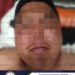 Detenido por atacar a policía de investigación en Cerritos