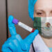 México suma 40,186 casos confirmados y 4,220 muertes por coronavirus